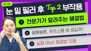 눈밑 필러 후 부작용! 푸르스름+울퉁불퉁 원인은? 해결까지!