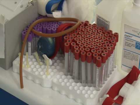 27.01.2017 / Ştire Etv - Numărul donatorilor, în creștere!