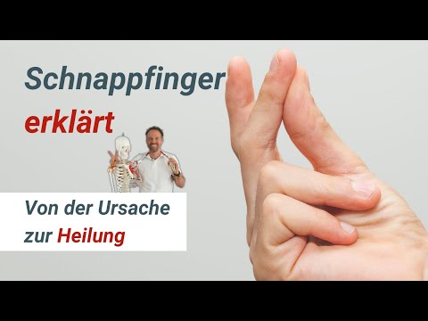 Trigger finger: Understand the causes, treat effectively! 💡