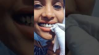 Moga Tattoo Gerji 0920703089 አድራሻችን አዲስ አበባ ገርጂ ንቅሳት እንሰራለን የተበላሹ ንቅሳቶቹን እናስተካክላለን እናጠፋለን#everyone