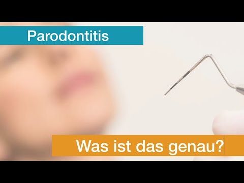 Volkskrankheit Parodontitis