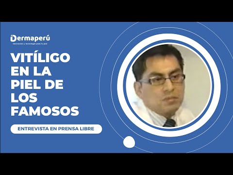 Entrevista Dr. Aparcana – Prensa Libre – TRATAMIENTO VITILIGO