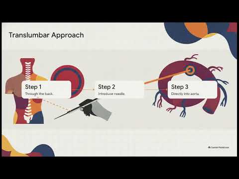 Cpt Code 36160 Explained Translumbar Aortography Coding Made Simple