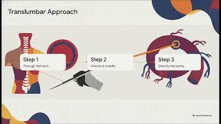 CPT Code 36160 EXPLAINED: Translumbar Aortography Coding Made Simple