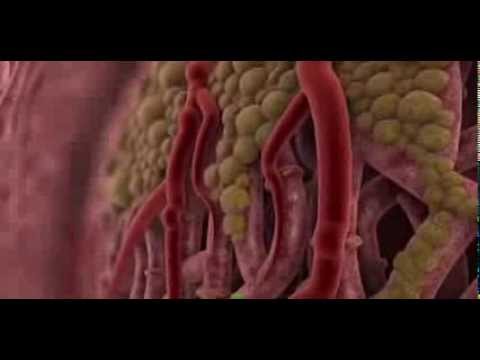 "fight or flight response