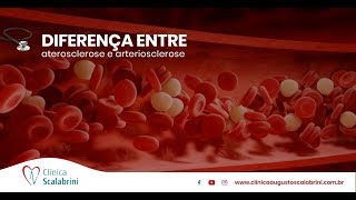 Diferença Entre Aterosclerose E Arteriosclerose