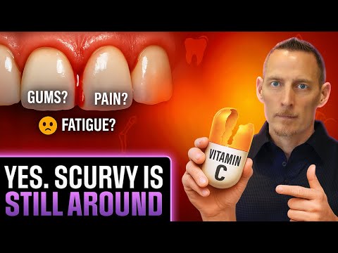 The Hidden Epidemic: Why Vitamin C Deficiency Is Making Millions Sick!