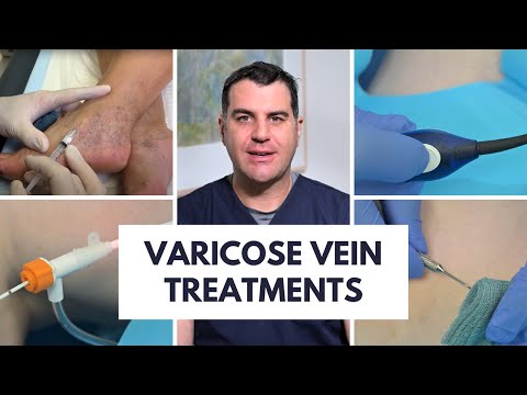 Varicose Vein Treatment Options - Dr Peter Paraskevas from Vein Health Medical Clinic