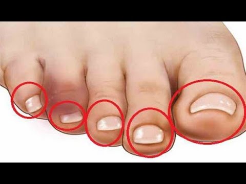 Pompa untuk pembesaran penis sebagai Seledri untuk potensi laki-laki