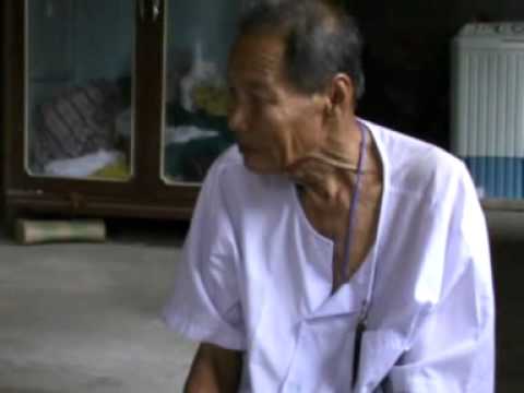 ผิวหนังและเล็บโรคสะเก็ดเงิน ดิแอซและโรคสะเก็ดเงิน
