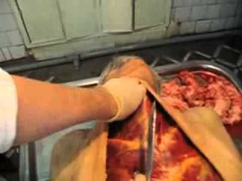 Die Würde Des Mannes Ist Unten Tastbar - Vaginal Cadaver