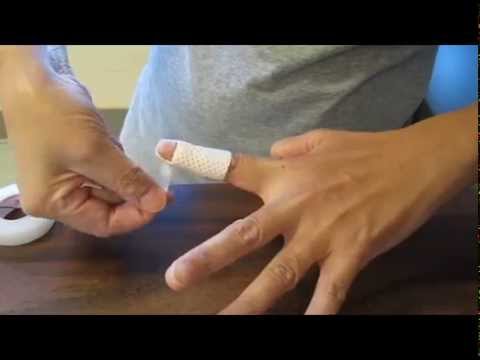 Mallet finger injury splint