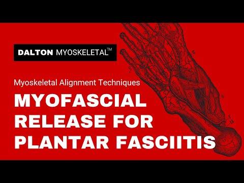 Use These Deep Tissue Myofascial Release Techniques for Plantar Fasciitis Treatment