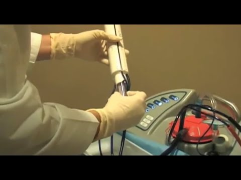 Ultrasound-Guided Breast Biopsy with ATEC: Procedure Demonstration