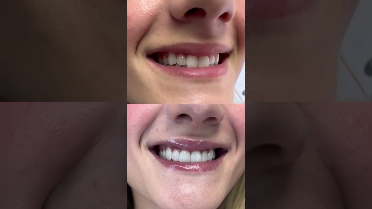 Alessandro Ricciardi-33