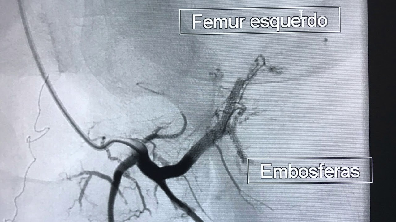 Felipe Soares Ribeiro-17