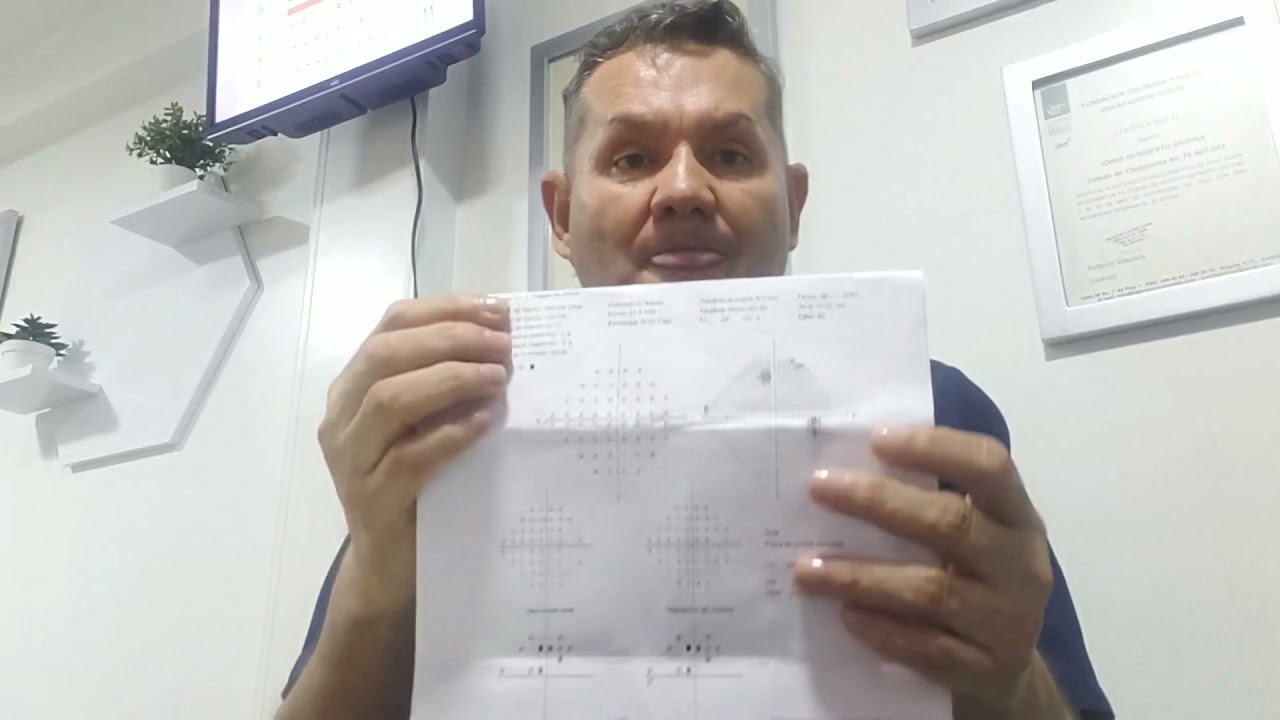 COMO LEER UN CAMPO VISUAL COMPUTARIZADO