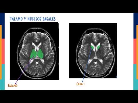 NEUROANATOMÍA EN RESONANCIA MAGNETICA.