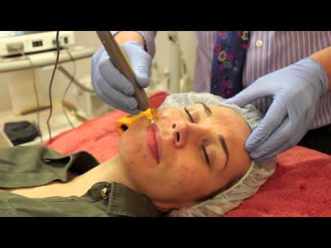 Pelleve | Dermatherapy Clinic  I Stratford upon Avon