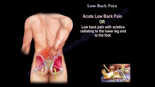 Low Back Pain - Everything You Need To Know - Dr. Nabil Ebraheim