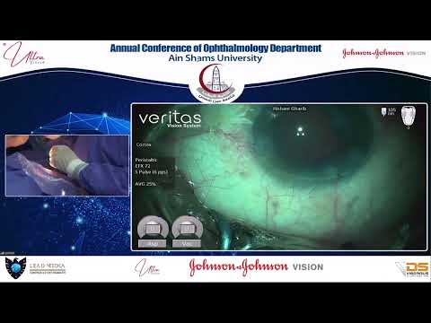 Cataract Patient Story 2