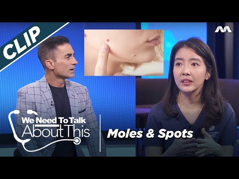 Moles & Spots - Discover the dangers of DIY mole removal | We Need To Talk About This