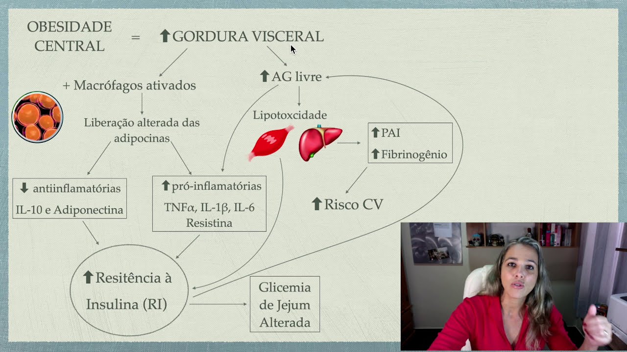 Síndrome Metabólica Parte 2