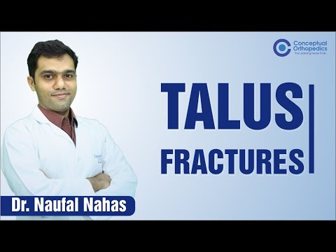 Talus Fractures by Dr. Naufal Nahas  @Conceptual Orthopedics