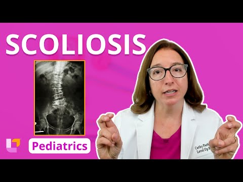 Scoliosis: Musculoskeletal System - Pediatric Nursing | @LevelUpRN Delete.​