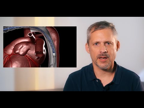 Die chirurgische Therapie der Typ A-Aortendissektion