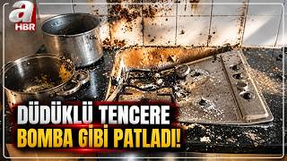 Düdüklü Tencere Bomba Gibi Patladı! "Hızlı Pişsin Diye Yaralanmayın! |