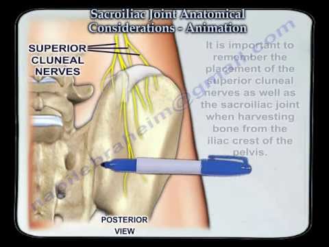Sacroiliac Joint dysfunction - Everything You Need To Know - Dr. Nabil Ebraheim