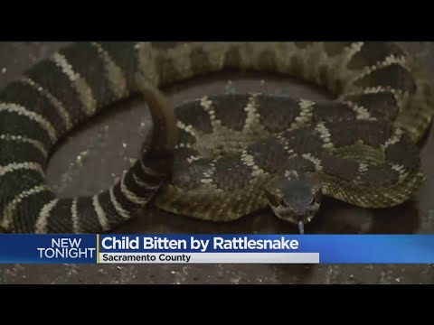 After Rattlesnake Bites Girl, Warnings Are Out At Effie Yeaw Nature Center