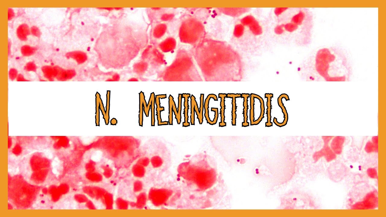 Neisseria Meningitidis