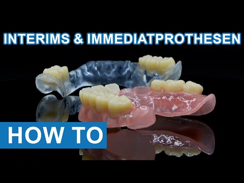Interim fully digital l tutorial