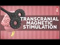 Transcranial Magnetic Stimulation How Does That Work