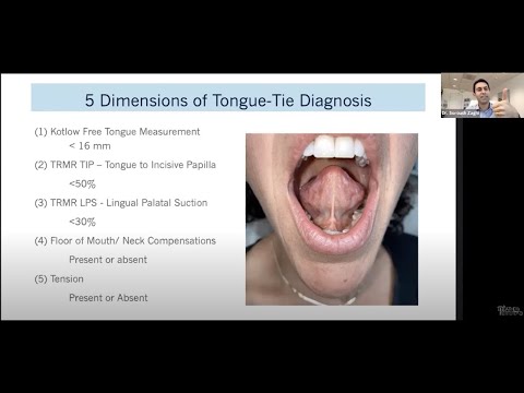 "Do I Have A Tongue-Tie?" - 5 dimensions of tongue-tie assessment, Dr. Zaghi - The Breathe Course