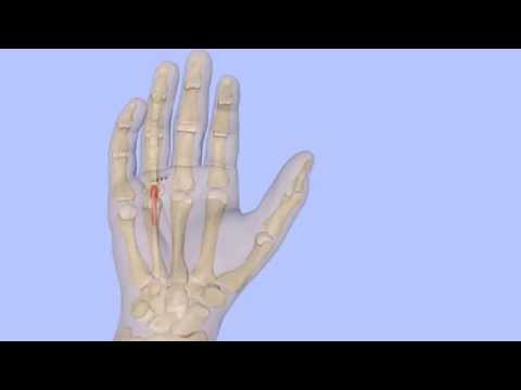 Trigger Finger Release