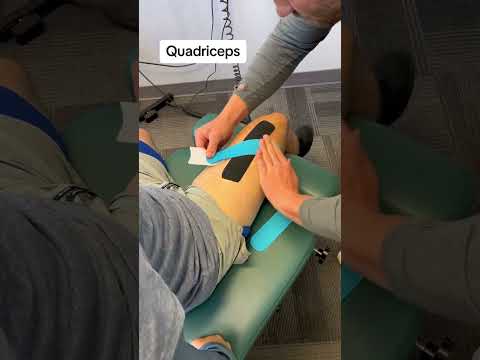 Taping the quads #physiotherapy #fitness #chiropractor #backpain #stretch #workout #painrelief