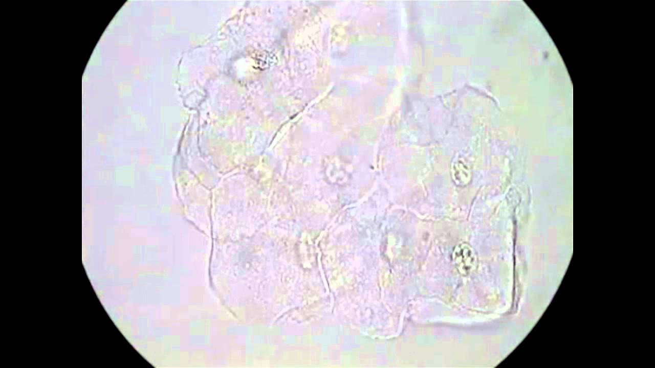 Examination of Vaginal Wet Preps