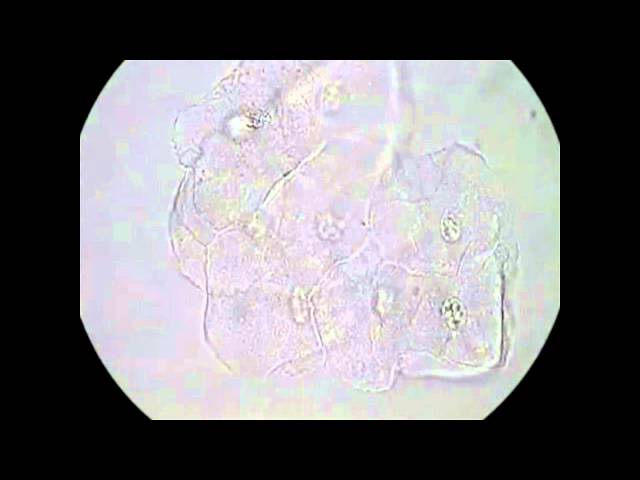 Výslovnost videa pseudohyphae v Anglický