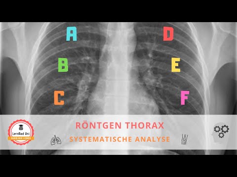 Systematische Auswertung Röntgen Thorax – so gehst du vor!