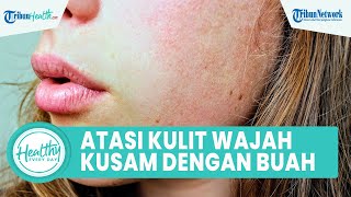 Memiliki Kulit Wajah Kusam Bisa Diatasi dengan Konsumsi Buah, Berikut Caranya