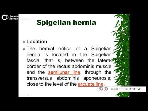 Quiz powerpoint video - Case 184