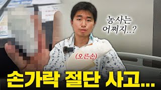 농장에서 일하다 손가락이 절단됐습니다...