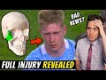 Full Details of Kevin de Bruyne SEVERE Facial Fractures Revealed - Doctor Explains