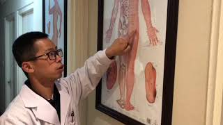 3-minute Chinese Medicine Study---Sciatica