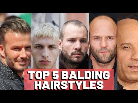 Hairstyles For Balding Men - Our TOP 5