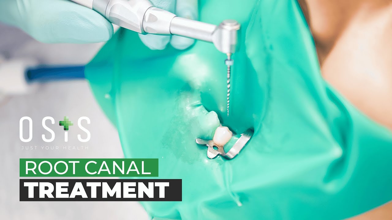 Root Canal Treatment