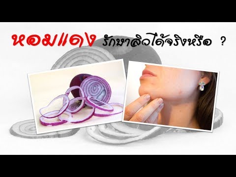 การขาดฮอร์โมนเพศชายขนาดเล็กกระเจี๊ยว ผักชีฝรั่งและความแข็งแรงชาย